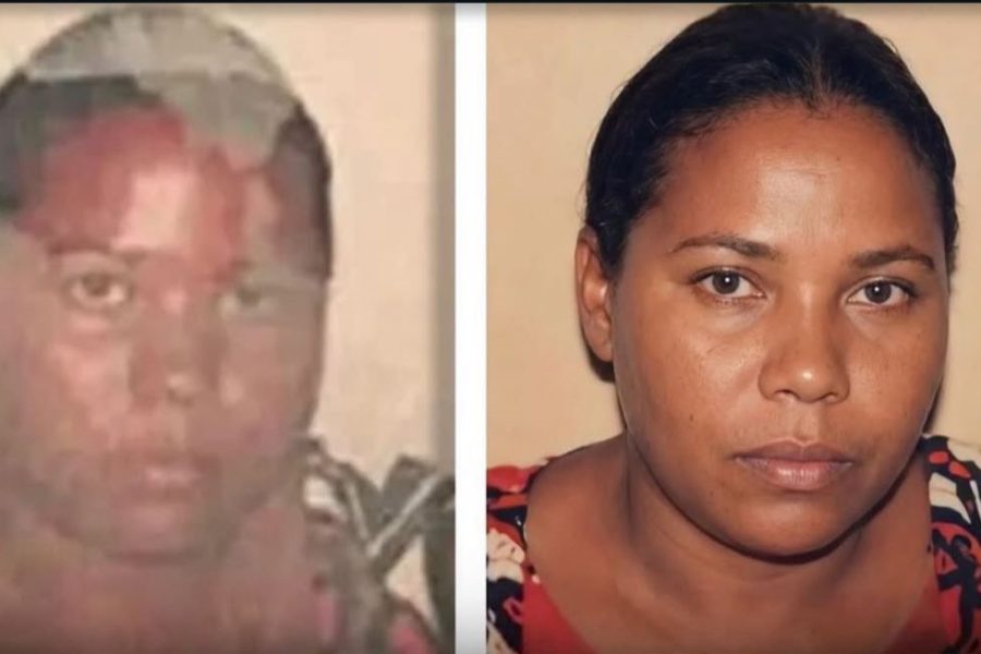 Mulher morre após dias internada depois de ataque a tiros em Brejo Santo