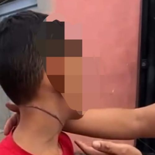 Criança se fere ao ficar presa em cabos soltos em Juazeiro do Norte