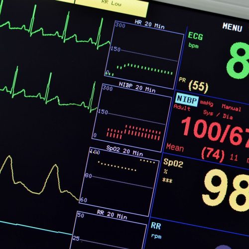 Inteligência artificial auxilia diagnóstico de doenças cardíacas e salva vidas